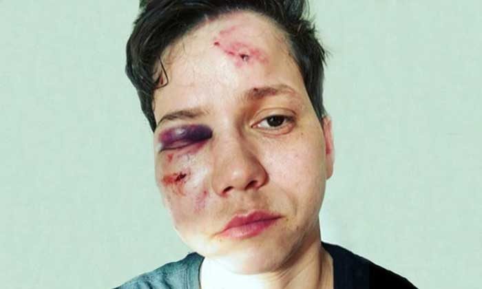 youtuber karol eller agredida no rio
